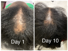 Load image into Gallery viewer, Hair Growth Serum