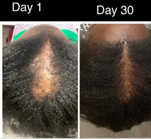 Load image into Gallery viewer, Hair Growth Serum