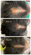 Load image into Gallery viewer, Hair Growth Serum