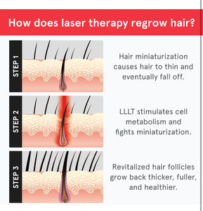 iRestore Essential Laser Hair Growth System - FDA Cleared Hair Loss Treatments for Men & Women & Hair Growth Products for Men with Thinning Hair, Hair Regrowth Treatments Laser Cap, Red Light Therapy